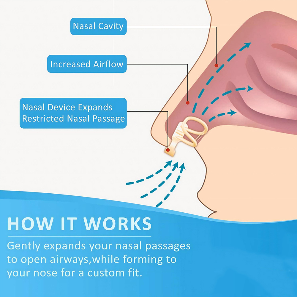 Anti Snore Nasal Dilator Stop  - Anti Snore Contour Pillow 评论和价格